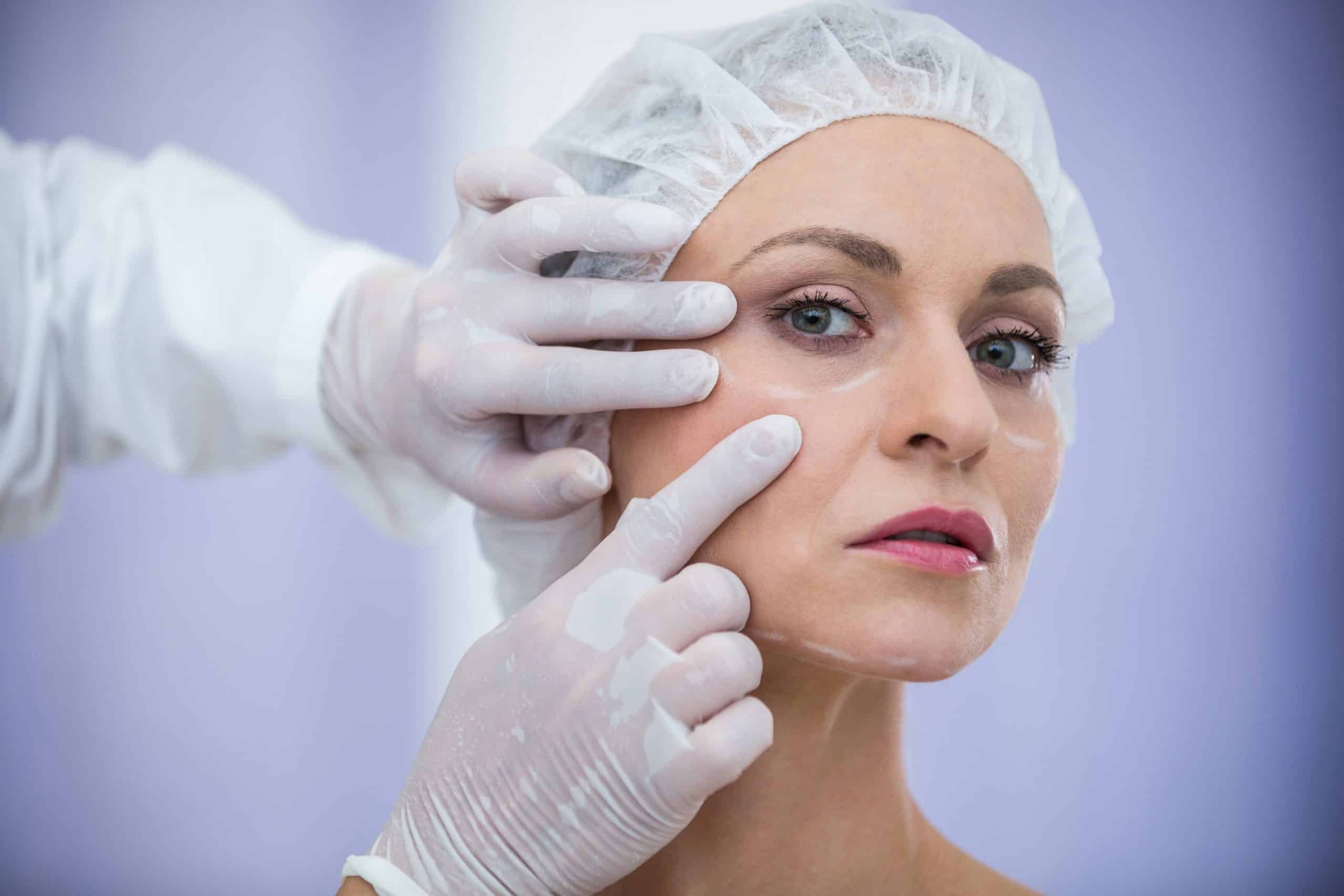 🌟 Blefaroplastia: El Tratamiento que Revolucionará tu Mirada y tu Confianza 💄✨